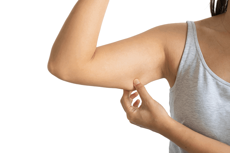 brachioplastie lifting bras chirurgie esthetique femme dr thierry ktorza specialiste medecine esthetique paris brachioplastie lifting bras chirurgie esthetique femme dr thierry ktorza specialiste medecine esthetique paris