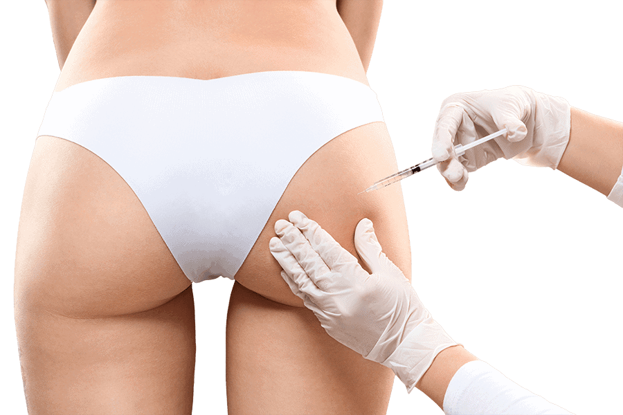 injection fesses acide hyaluronique medecine esthetique silhouette femme homme dr thierry ktorza specialiste medecine esthetique paris