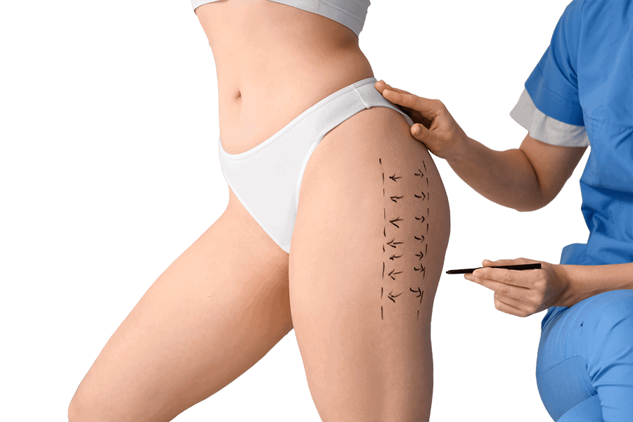 lifting cuisses chirurgie esthetique femme dr thierry ktorza specialiste medecine esthetique paris