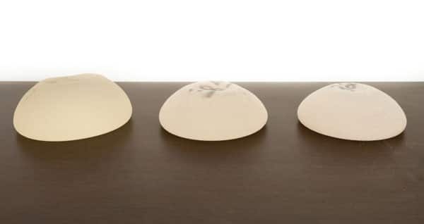 Implants mammaires en silicone ou sérum physiologique ?