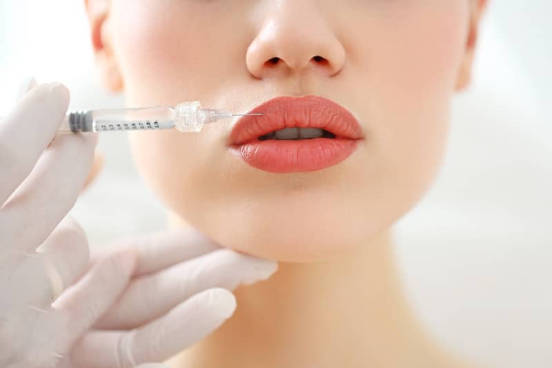 Russian lips : La méthode russe pour augmenter le volume des lèvres
